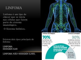 LINFOMA
Linfoma é um tipo de
câncer que se inicia
nas células que fazem
parte do sistema
imunológico.
O Sistema linfático.
Existem dois tipos principais de
linfoma:
LINFOMA
HODGKIN (LH)
LINFOMA NÃO-HODGKIN (LNH).
 