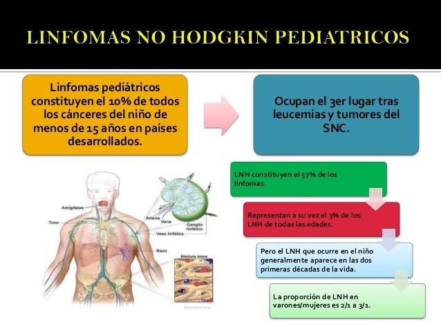 Linfoma no hodgkin