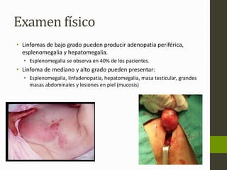 Examen físico 
• Linfomas de bajo grado pueden producir adenopatía periférica, 
esplenomegalia y hepatomegalia. 
• Esplenomegalia se observa en 40% de los pacientes. 
• Linfoma de mediano y alto grado pueden presentar: 
• Esplenomegalia, linfadenopatia, hepatomegalia, masa testicular, grandes 
masas abdominales y lesiones en piel (mucosis) 
 