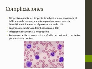 Complicaciones 
• Citopenias (anemia, neutropenia, trombocitopenia) secundaria al 
infiltrado de la medula, además se puede observar anemia 
hemolítica autoinmune en algunas variantes de LNH. 
• Sangrados secundarios a trombocitopenia o CID 
• Infecciones secundarias a neutropenia 
• Problemas cardiacos secundarios a efusión del pericardio o arritmias 
por metástasis cardiaca. 
 