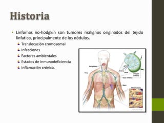• Linfomas no-hodgkin son tumores malignos originados del tejido 
linfatico, principalmente de los nódulos. 
Translocación cromosomal 
Infecciones 
Factores ambientales 
Estados de inmunodeficiencia 
Inflamación crónica. 
 