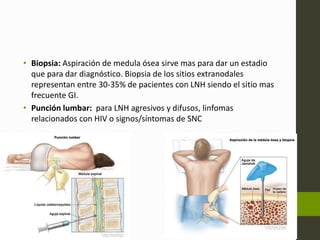 • Biopsia: Aspiración de medula ósea sirve mas para dar un estadio 
que para dar diagnóstico. Biopsia de los sitios extranodales 
representan entre 30-35% de pacientes con LNH siendo el sitio mas 
frecuente GI. 
• Punción lumbar: para LNH agresivos y difusos, linfomas 
relacionados con HIV o signos/síntomas de SNC 
 