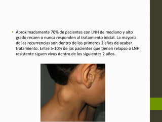 • Aproximadamente 70% de pacientes con LNH de mediano y alto 
grado recaen o nunca responden al tratamiento inicial. La mayoría 
de las recurrencias son dentro de los primeros 2 años de acabar 
tratamiento. Entre 5-10% de los pacientes que tienen relapso o LNH 
resistente siguen vivos dentro de los siguientes 2 años. 

