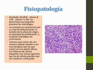 • Alrededor del 85% - células B, 
15% - células T y NK. Un 
porcentaje muy pequeño 
proviene de macrófagos. 
• Los tumores se caracterizan por 
su nivel de diferenciación, el 
tamaño de la célula de origen, 
la velocidad de proliferación, y 
el patrón histológico de 
crecimiento. 
• Tumores que crecen de una 
manera nodular tienden a ser 
mas benignos que los que 
crecen en una patrón difuso. 
Los linfomas de células 
pequeñas son menos agresivos 
que los de células grandes que 
son mediano y alto grado 
 