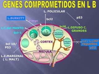 L. FOLICULAR

   L.BURKITT                                                  p53
                           bcl2
                c-myc

                                      bcl6 L.DIFUSO C.
L.C.del MANTO
                                             GRANDES
       bcl-1                      FOLICULO
                                  PRIMARIO




                        CORTEX               Linfocitos   ?     LLC/ L.LINF.
  bcl 10/                                     B.CD5+
                                                                PEQUEÑOS
  P53                                                                p53
                        MEDULA
L.Z.MARGINAL
 ( L. MALT)
 