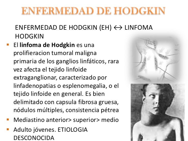 Enfermedad De Hodgkin Sintomas Related Keywords Enfermedad De Hodgkin Sintomas Related Keywords