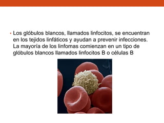 • Los glóbulos blancos, llamados linfocitos, se encuentran

en los tejidos linfáticos y ayudan a prevenir infecciones.
La mayoría de los linfomas comienzan en un tipo de
glóbulos blancos llamados linfocitos B o células B

 