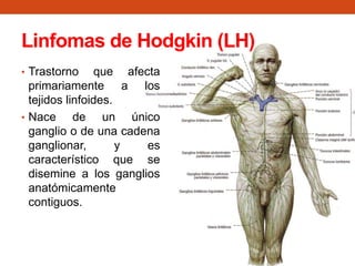 Linfomas de Hodgkin (LH)
• Trastorno

que afecta
primariamente a los
tejidos linfoides.
• Nace
de un único
ganglio o de una cadena
ganglionar,
y
es
característico que se
disemine a los ganglios
anatómicamente
contiguos.

 