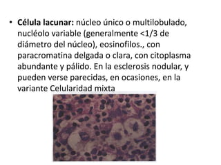 • Célula lacunar: núcleo único o multilobulado,
nucléolo variable (generalmente <1/3 de
diámetro del núcleo), eosinofilos., con
paracromatina delgada o clara, con citoplasma
abundante y pálido. En la esclerosis nodular, y
pueden verse parecidas, en ocasiones, en la
variante Celularidad mixta
 
