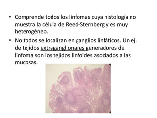 • Comprende todos los linfomas cuya histología no
muestra la célula de Reed-Sternberg y es muy
heterogéneo.
• No todos se localizan en ganglios linfáticos. Un ej.
de tejidos extraganglionares generadores de
linfoma son los tejidos linfoides asociados a las
mucosas.
 