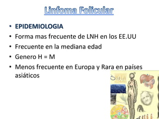 • EPIDEMIOLOGIA
• Forma mas frecuente de LNH en los EE.UU
• Frecuente en la mediana edad
• Genero H = M
• Menos frecuente en Europa y Rara en países
asiáticos
 