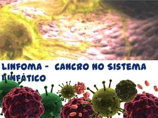 Linfoma –  Cancro no Sistema Linfático 