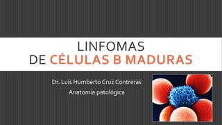 LINFOMAS
DE CÉLULAS B MADURAS
Dr. Luis Humberto Cruz Contreras
Anatomía patológica

 