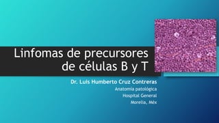 Linfomas de precursores
de células B y T
Dr. Luis Humberto Cruz Contreras
Anatomía patológica
Hospital General
Morelia, Méx
 