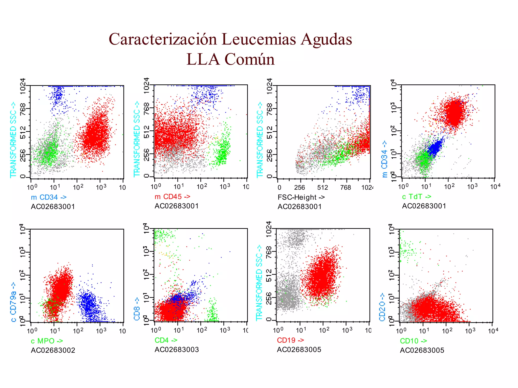10 10 10 10 100 1 2 3 4
AC02683001
m CD34 ->
10 10 10 10 100 1 2 3 4
AC02683001
m CD45 ->
0 256 512 768 1024
AC02683001
FSC-Height ->
10 10 10 10 100 1 2 3 4
AC02683001
c TdT ->
10 10 10 10 100 1 2 3 4
AC02683002
c MPO ->
10 10 10 10 100 1 2 3 4
AC02683003
CD4 ->
10 10 10 10 100 1 2 3 4
AC02683005
CD19 ->
10 10 10 10 100 1 2 3 4
AC02683005
CD10 ->
Caracterización Leucemias Agudas
LLA Común
 