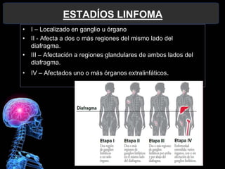 13
ESTADÍOS LINFOMA
• I – Localizado en ganglio u órgano
• II - Afecta a dos o más regiones del mismo lado del
diafragma.
• III – Afectación a regiones glandulares de ambos lados del
diafragma.
• IV – Afectados uno o más órganos extralinfáticos.
 