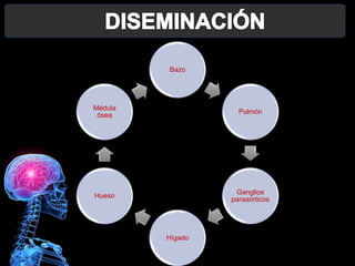 Bazo
Pulmón
Ganglios
paraaórticos
Hígado
Hueso
Médula
ósea
 