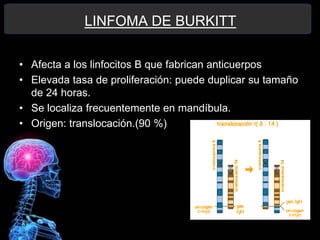23
LINFOMA DE BURKITT
• Afecta a los linfocitos B que fabrican anticuerpos
• Elevada tasa de proliferación: puede duplicar su tamaño
de 24 horas.
• Se localiza frecuentemente en mandíbula.
• Origen: translocación.(90 %)
 
