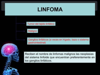 3
LINFOMA
Reciben el nombre de linfomas malignos las neoplasias
del sistema linfoide que encuentran preferentemente en
los ganglios linfáticos.
Tumor del tejido linfático
Maligno
Ganglios linfáticos (a veces en hígado, bazo o sistema
gastrointestinal)
 