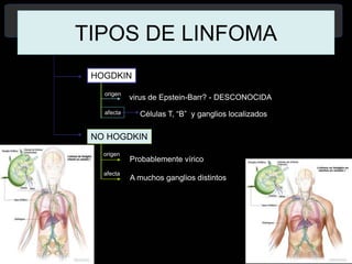 5
TIPOS DE LINFOMA
HOGDKIN
virus de Epstein-Barr? - DESCONOCIDA
Células T, “B” y ganglios localizados
NO HOGDKIN
Probablemente vírico
A muchos ganglios distintos
origen
afecta
origen
afecta
 