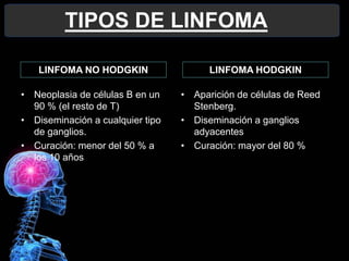 7
TIPOS DE LINFOMA
• Neoplasia de células B en un
90 % (el resto de T)
• Diseminación a cualquier tipo
de ganglios.
• Curación: menor del 50 % a
los 10 años
• Aparición de células de Reed
Stenberg.
• Diseminación a ganglios
adyacentes
• Curación: mayor del 80 %
LINFOMA NO HODGKIN LINFOMA HODGKIN
 