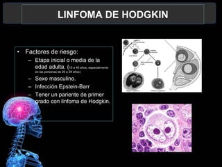 8
LINFOMA DE HODGKIN
• Factores de riesgo:
– Etapa inicial o media de la
edad adulta. (15 a 40 años, especialmente
en las personas de 20 a 29 años)
– Sexo masculino.
– Infección Epstein-Barr
– Tener un pariente de primer
grado con linfoma de Hodgkin.
 