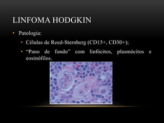 LINFOMA HODGKIN
• Patologia:
• Células de Reed-Sternberg (CD15+, CD30+);
• “Pano de fundo” com linfócitos, plasmócitos e
eosinófilos.

 
