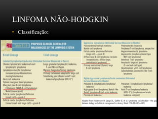 LINFOMA NÃO-HODGKIN
• Classificação:

 