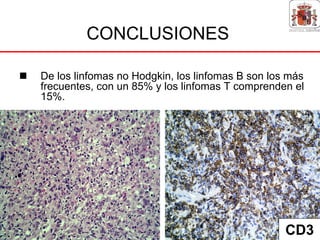 CONCLUSIONES

De los linfomas no Hodgkin, los linfomas B son los más
frecuentes, con un 85% y los linfomas T comprenden el
15%.




                                                  CD3
 