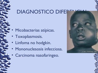 DIAGNOSTICO DIFERENCIAL
• Micobacterias atípicas.
• Toxoplasmosis.
• Linfoma no hodgkin.
• Mononuclesosis infecciosa.
• Carcinoma nasofaringeo.
 