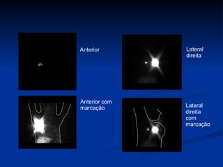 Anterior Anterior com marcação Lateral direita Lateral direita com marcação 