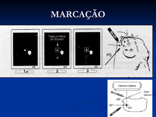 MARCAÇÃO 