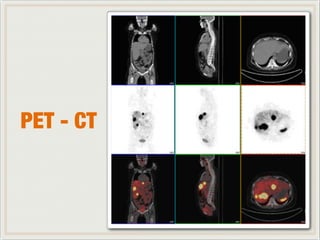 PET - CT 
 