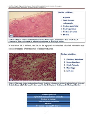 Dra. Elisa D’Angelo. Organos Linforeticulaes. . Anatomía Microscópica II. Sección Anatomía Microscópica.
Departamento Ciencias Morfológicas. Decanato Ciencias de la Salud. UCLA
13
Nódulo Linfático:
1. Cápsula
2. Seno linfático
subcapsular
3. Corteza superficial
4. Centro germinal
5. Corteza profunda
6. Médula
Corte H-E Nódulo linfático. Laboratorio Anatomía Microscópica. Decanato Cs de la Salud. UCLA.
Cortesia Dr. José Luis Cirella, Br. Reynaldo Rodriguez, Br. Mariangel Benitez
A nivel nivel de la médula, las células se agrupan en cordones celulares medulares que
ocupan el espacio entre los senos linfáticos medulares.
Nódulo Linfático:
1. Cordones Medulares
2. Senos Medulares
3. Célula Reticular
4. Macrófago
5. Linfocito
Corte H-E Senos y Cordones Medulares Nódulo linfático. Laboratorio Anatomía Microscópica. Decanato
Cs de la Salud. UCLA. Cortesia Dr. José Luis Cirella, Br. Reynaldo Rodriguez, Br. Mariangel Benitez
Corteza superficial:
Tejido linforreticular difuso y nodular
Corteza profunda:
Tejido linforreticular difuso
Médula:
Cordones y senbos Medulares
 