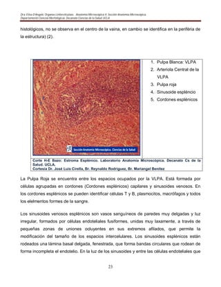 Dra. Elisa D’Angelo. Organos Linforeticulaes. . Anatomía Microscópica II. Sección Anatomía Microscópica.
Departamento Ciencias Morfológicas. Decanato Ciencias de la Salud. UCLA
23
histológicos, no se observa en el centro de la vaina, en cambio se identifica en la periféria de
la estructura) (2).
1. Pulpa Blanca: VLPA
2. Arteriola Central de la
VLPA
3. Pulpa roja
4. Sinusoide espléncio
5. Cordones esplénicos
Corte H-E Bazo: Estroma Esplénico. Laboratorio Anatomía Microscópica. Decanato Cs de la
Salud. UCLA.
Cortesia Dr. José Luis Cirella, Br. Reynaldo Rodriguez, Br. Mariangel Benitez
La Pulpa Roja se encuentra entre los espacios ocupados por la VLPA. Está formada por
células agrupadas en cordones (Cordones esplénicos) capilares y sinusoides venosos. En
los cordones esplénicos se pueden identificar células T y B, plasmocitos, macrófagos y todos
los elelmentos formes de la sangre.
Los sinusoides venosos esplénicos son vasos sanguíneos de paredes muy delgadas y luz
irregular, formados por células endoteliales fusiformes, unidas muy laxamente, a través de
pequeñas zonas de uniones ocluyentes en sus extremos afilados, que permite la
modificación del tamaño de los espacios intercelulares. Los sinusoides esplénicos están
rodeados una lámina basal delgada, fenestrada, que forma bandas circulares que rodean de
forma incompleta el endotelio. En la luz de los sinusoides y entre las células endoteliales que
 