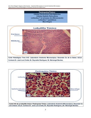 Dra. Elisa D’Angelo. Organos Linforeticulaes. . Anatomía Microscópica II. Sección Anatomía Microscópica.
Departamento Ciencias Morfológicas. Decanato Ciencias de la Salud. UCLA
5
ParénquimaTímico:
Células Dendríticas Interdigitantes
Células Epitelio Reticulares
Linfocitos T en proceso de diferenciación
Linfocitos T apotóticos
Macrófagos
Corte Histológico Timo H-E: Laboratorio Anatomía Microscópica. Decanato Cs de la Salud. UCLA.
Cortesia Dr. José Luis Cirella, Br. Reynaldo Rodriguez, Br. Mariangel Benitez.
Corte H-E de un lobulillo tímico: Parénquima Tímico. Laboratorio Anatomía Microscópica. Decanato Cs
de la Salud. UCLA. Cortesia Dr. José Luis Cirella, Br. Reynaldo Rodriguez y Br. Mariangel Benitez.
 