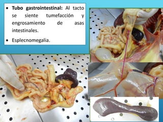  Tubo gastrointestinal: Al tacto
se siente tumefacción y
engrosamiento de asas
intestinales.
 Esplecnomegalia.
 