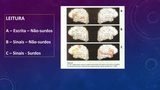 LEITURA
A – Escrita – Não-surdos
B – Sinais – Não-surdos
C – Sinais - Surdos
A
B
C
 