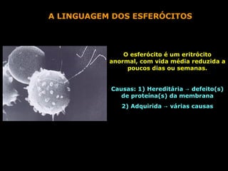 A LINGUAGEM DOS ESFERÓCITOS



               O esferócito é um eritrócito
           anormal, com vida média reduzida a
                poucos dias ou semanas.


           Causas: 1) Hereditária → defeito(s)
              de proteína(s) da membrana
              2) Adquirida → várias causas
 