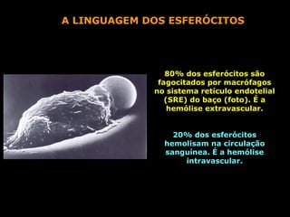 A LINGUAGEM DOS ESFERÓCITOS




                80% dos esferócitos são
              fagocitados por macrófagos
             no sistema retículo endotelial
                (SRE) do baço (foto). É a
                 hemólise extravascular.


                 20% dos esferócitos
               hemolisam na circulação
               sanguínea. É a hemólise
                   intravascular.
 