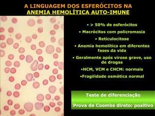 A LINGUAGEM DOS ESFERÓCITOS NA
 ANEMIA HEMOLÍTICA AUTO-IMUNE

                   • > 50% de esferócitos
               • Macrócitos com policromasia
                      • Reticulocitose
             • Anemia hemolítica em diferentes
                       fases da vida
             • Geralmente após virose grave, uso
                         de drogas
                •HCM, VCM e CHCM: normais
                •Fragilidade osmótica normal



                  Teste de diferenciação

             Prova de Coombs direto: positivo
 