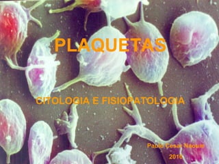 PLAQUETAS

CITOLOGIA E FISIOPATOLOGIA



                   Paulo Cesar Naoum
                         2010
 