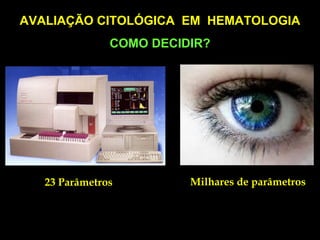 AVALIAÇÃO CITOLÓGICA EM HEMATOLOGIA
               COMO DECIDIR?




   23 Parâmetros         Milhares de parâmetros
 