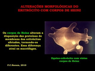 ALTERAÇÕES MORFOLÓGICAS DO
           ERITRÓCITO COM CORPOS DE HEINZ




Os corpos de Heinz alteram a
 disposição das proteínas de
  membrana dos eritrócitos
    afetados, tornando-os
  diferentes. Essa diferença
     atrai os macrófagos.


                               Equino-esferócito com vários
                                     corpos de Heinz
   P.C.Naoum, 2010
 