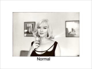 Normal
 