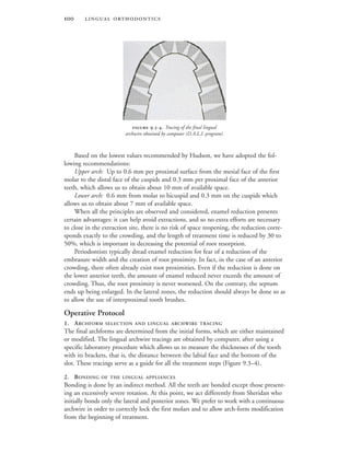  
Based on the lowest values recommended by Hudson, we have adopted the fol-
lowing recommendations:
Upper arch: Up to 0.6 mm per proximal surface from the mesial face of the first
molar to the distal face of the cuspids and 0.3 mm per proximal face of the anterior
teeth, which allows us to obtain about 10 mm of available space.
Lower arch: 0.6 mm from molar to bicuspid and 0.3 mm on the cuspids which
allows us to obtain about 7 mm of available space.
When all the principles are observed and considered, enamel reduction presents
certain advantages: it can help avoid extractions, and so no extra efforts are necessary
to close in the extraction site, there is no risk of space reopening, the reduction corre-
sponds exactly to the crowding, and the length of treatment time is reduced by 30 to
50%, which is important in decreasing the potential of root resorption.
Periodontists typically dread enamel reduction for fear of a reduction of the
embrasure width and the creation of root proximity. In fact, in the case of an anterior
crowding, there often already exist root proximities. Even if the reduction is done on
the lower anterior teeth, the amount of enamel reduced never exceeds the amount of
crowding. Thus, the root proximity is never worsened. On the contrary, the septum
ends up being enlarged. In the lateral zones, the reduction should always be done so as
to allow the use of interproximal tooth brushes.
Operative Protocol
1. ARCHFORM SELECTION AND LINGUAL ARCHWIRE TRACING
The final archforms are determined from the initial forms, which are either maintained
or modified. The lingual archwire tracings are obtained by computer, after using a
specific laboratory procedure which allows us to measure the thicknesses of the tooth
with its brackets, that is, the distance between the labial face and the bottom of the
slot. These tracings serve as a guide for all the treatment steps (Figure 9.3–4).
2. BONDING OF THE LINGUAL APPLIANCES
Bonding is done by an indirect method. All the teeth are bonded except those present-
ing an excessively severe rotation. At this point, we act differently from Sheridan who
initially bonds only the lateral and posterior zones. We prefer to work with a continuous
archwire in order to correctly lock the first molars and to allow arch-form modification
from the beginning of treatment.
 .-. Tracing of the final lingual
archwire obtained by computer (D.A.L.I. program).
 