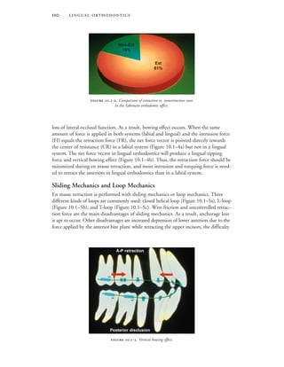  
loss of lateral occlusal function. As a result, bowing effect occurs. When the same
amount of force is applied in both systems (labial and lingual) and the intrusion force
(FI) equals the retraction force (FR), the net force vector is pointed directly towards
the center of resistance (CR) in a labial system (Figure 10.1–4a) but not in a lingual
system. The net force vector in lingual orthodontics will produce a lingual tipping
force and vertical bowing effect (Figure 10.1–4b). Thus, the retraction force should be
minimized during en masse retraction, and more intrusion and torquing force is need-
ed to retract the anteriors in lingual orthodontics than in a labial system.
Sliding Mechanics and Loop Mechanics
En masse retraction is performed with sliding mechanics or loop mechanics. Three
different kinds of loops are commonly used: closed helical loop (Figure 10.1–5a), L-loop
(Figure 10.1–5b), and T-loop (Figure 10.1–5c). Wire friction and uncontrolled retrac-
tion force are the main disadvantages of sliding mechanics. As a result, anchorage loss
is apt to occur. Other disadvantages are increased depression of lower anteriors due to the
force applied by the anterior bite plane while retracting the upper incisors, the difficulty
 .-. Comparison of extraction vs. nonextraction cases
in the Takemoto orthodontic office.
 .-. Vertical bowing effect.
Non-Ext
19%
Ext
81%
Posterior disclusion
A-P retraction
 