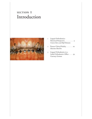  Lingual Orthodontics:
Historical Perspective. . . . . . . . . . 
Craven Kurz and Rafi Romano
 Present Clinical Reality. . . . . . . . 
Massimo Ronchin
 Lingual Orthodontics in a
Labial Orthodontics Office. . . . . 
Courtney Gorman
SECTION 1
Introduction
 