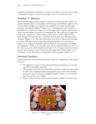  
mesially to the primary second molars to increase the resilience in this area and to apply
more gradual strength at a distance also occupy some of the interbracket space.
Pendulum “F” Mechanics
One of the advantages of early treatment is reduced treatment time due to the use of
specific mechanics from the early phases of the therapy. The Pendulum appliance that
was described by Hilghers was adapted and modified by the author for the lingual
technique and called Pendulum F (Figure 11–1). The lingual part of the bands are
provided with a double tube (Figure 11–2). The larger tube is used for stabilizing the
molars after distalization by means of a transpalatal bar. The acrylic part is larger than
usual to give support for a TMA archwire section which is used to align the front
teeth, through the lingual brackets, which have been bonded since the beginning of
treatment (Figure 11–3). This type of archwire can be bent in various ways according
to its use, with expansion or contraction loops and intrusion or extrusion forces
(Figure 11–4). It permits immediate, decisive alignment and increases the anchorage
to the appliance. Thanks to the bite effect of the anterior lingual brackets, the arch is set
free, allowing a greater molar distalization (Figure 11–5). A tongue crib can be inserted
into the acrylic button in cases of open-bite and tongue-thrust habits (Figure 11–6).
Pendulum F can be also used as an orthopedic maxillary expander (Figure 11–7).
Laboratory Procedures
Specific instructions to the laboratory should be given for young patients with decidu-
ous teeth:
1. The diagnostic program of each patient should be described since we are deal-
ing with an interceptive treatment.
2. The deciduous dental elements that will be extracted or reduced in size should
be taken into consideration while preparing the set-up, such as the deciduous
canines that may be extracted or stripped mesially to obtain a correct position-
ing of the incisors at the midline.
3. The use of the retraction cord in partially erupted, crowded, or rotated teeth
 -. Pendulum F used as an orthopedic maxillary
expander.
 