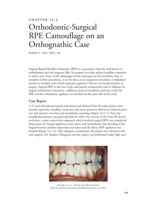 
Surgical Rapid Maxillary Expansion (RPE) is a procedure relatively well known to
orthodontists and oral surgeons alike. Its purpose is to help achieve maxillary expansion
in adult cases. Some of the advantages of this technique are less morbidity than in
complete LeFort procedures; it can be done as an outpatient procedure; a midpalatal
incision is avoided; and a fixed expansion appliance (Hyrax) can be placed prior to
surgery. Surgical RPE is also less costly, and patient recuperation time is reduced. In
lingual orthodontic treatments, a different protocol should be used since both the
RPE and the orthodontic appliance are bonded on the same side of the teeth.
Case Report
A 27-year-old male presented with dental and skeletal Class III malocclusion with
anterior open bite, maxillary transverse and antero-posterior deficiency, bilateral poste-
rior and anterior cross-bite and mandibular crowding (Figure 12.2–1). Since the
mandibular position was good and did not reflect the severity of the Class III dental
occlusion, a more conservative approach which involved surgical RPE was considered.
Impressions for lingual appliances were taken, and immediately after bonding of the
lingual brackets another impression was taken and the Hyrax RPE appliance was
bonded (Figure 12.2–2). After adequate consultation, the patient was referred to the
oral surgeon (Dr. Stephen Nahigian) and the surgery was performed under light anes-
 .
Orthodontic-Surgical
RPE Camouflage on an
Orthognathic Case
MARIO E. PAZ, DDS, MS
 .-. Frontal view before treatment:
Note the open bite and anterior and bilateral posterior cross-bites.
 